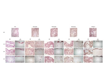 Bone regeneration using hydrostatic pressure-loaded bone marrow-derived mesenchymal stem cells