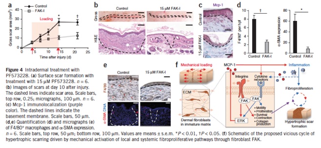 Analysis of focal adhesion kinase in animal models bearing hypertrophic scars