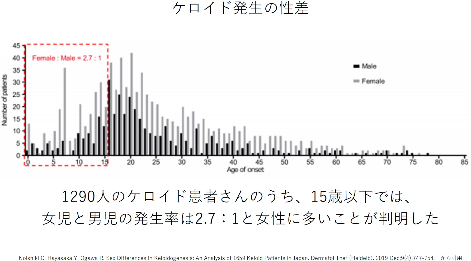 5. ケロイドは女性に多く発症する