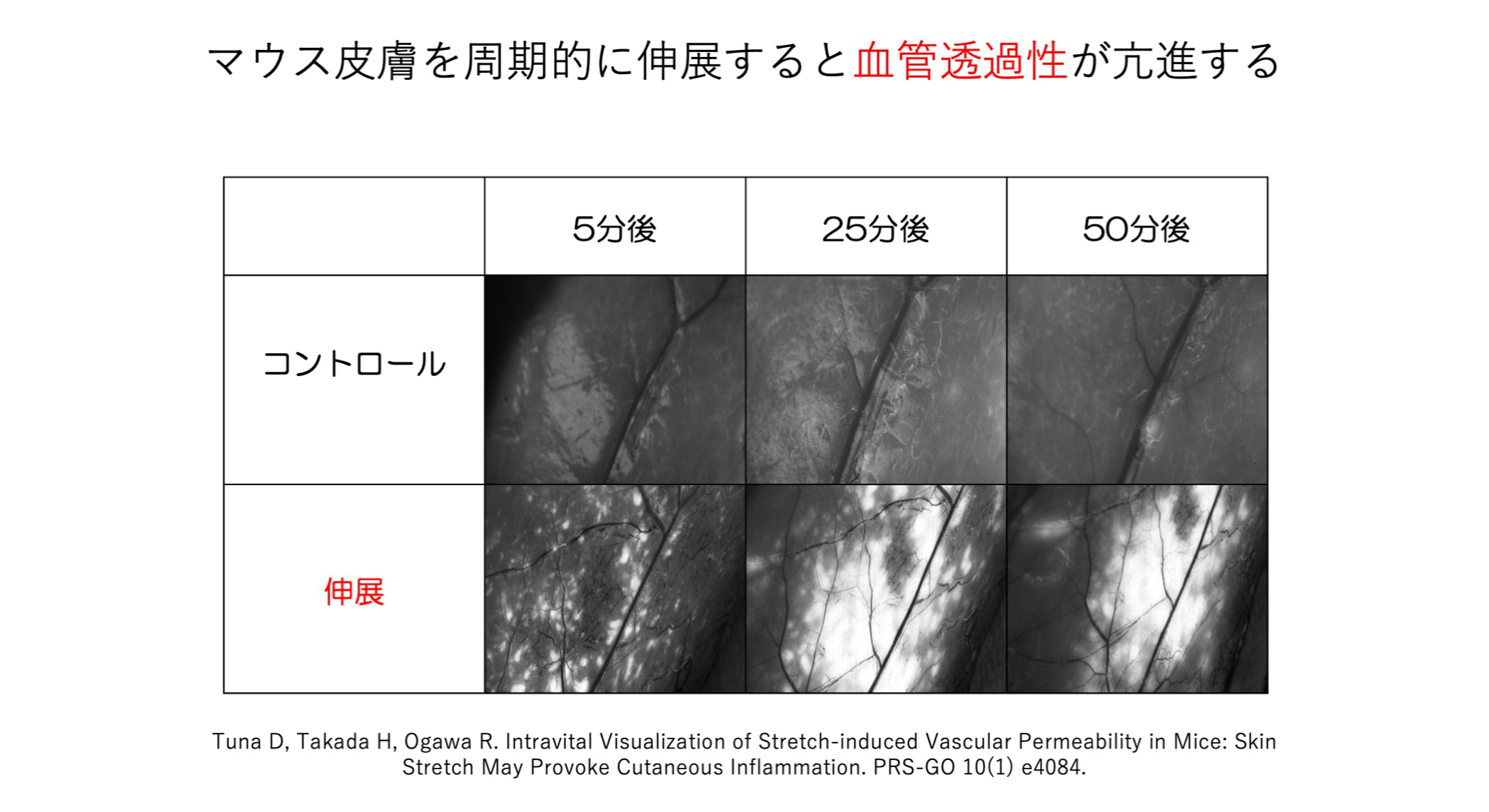 14. 皮膚に張力がかかると血管透過性が亢進する