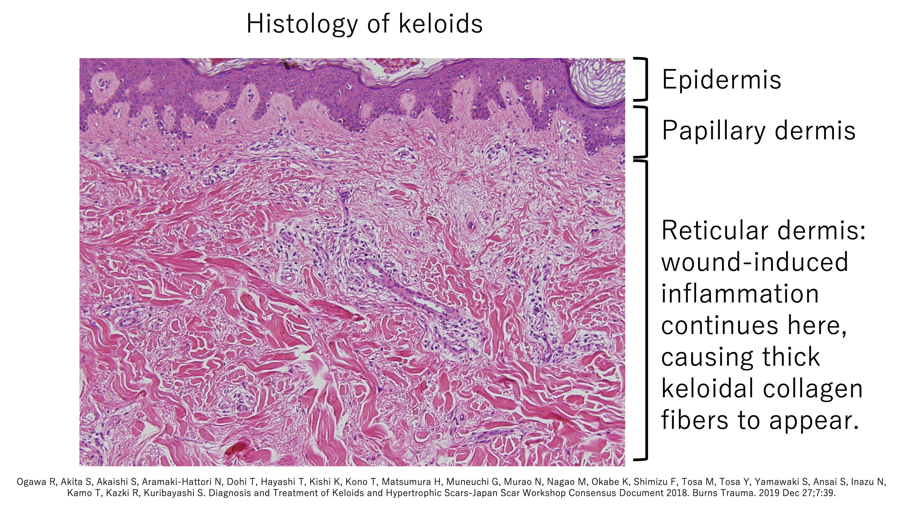 keloid laboratory