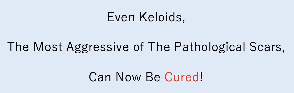 keloid laboratory