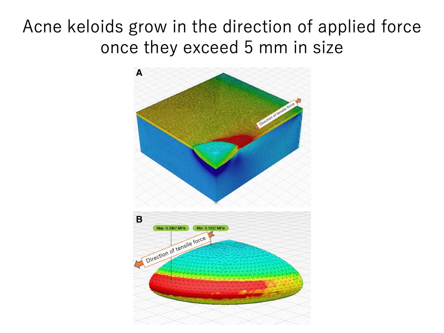 keloid laboratory