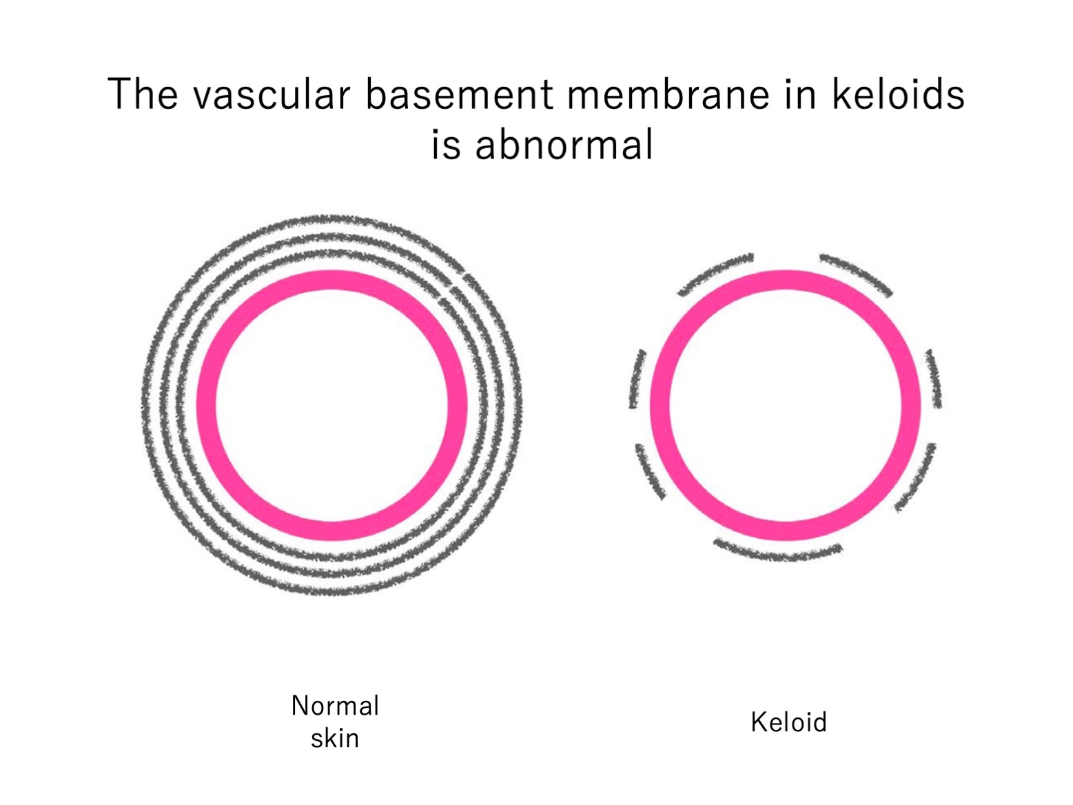 keloid laboratory