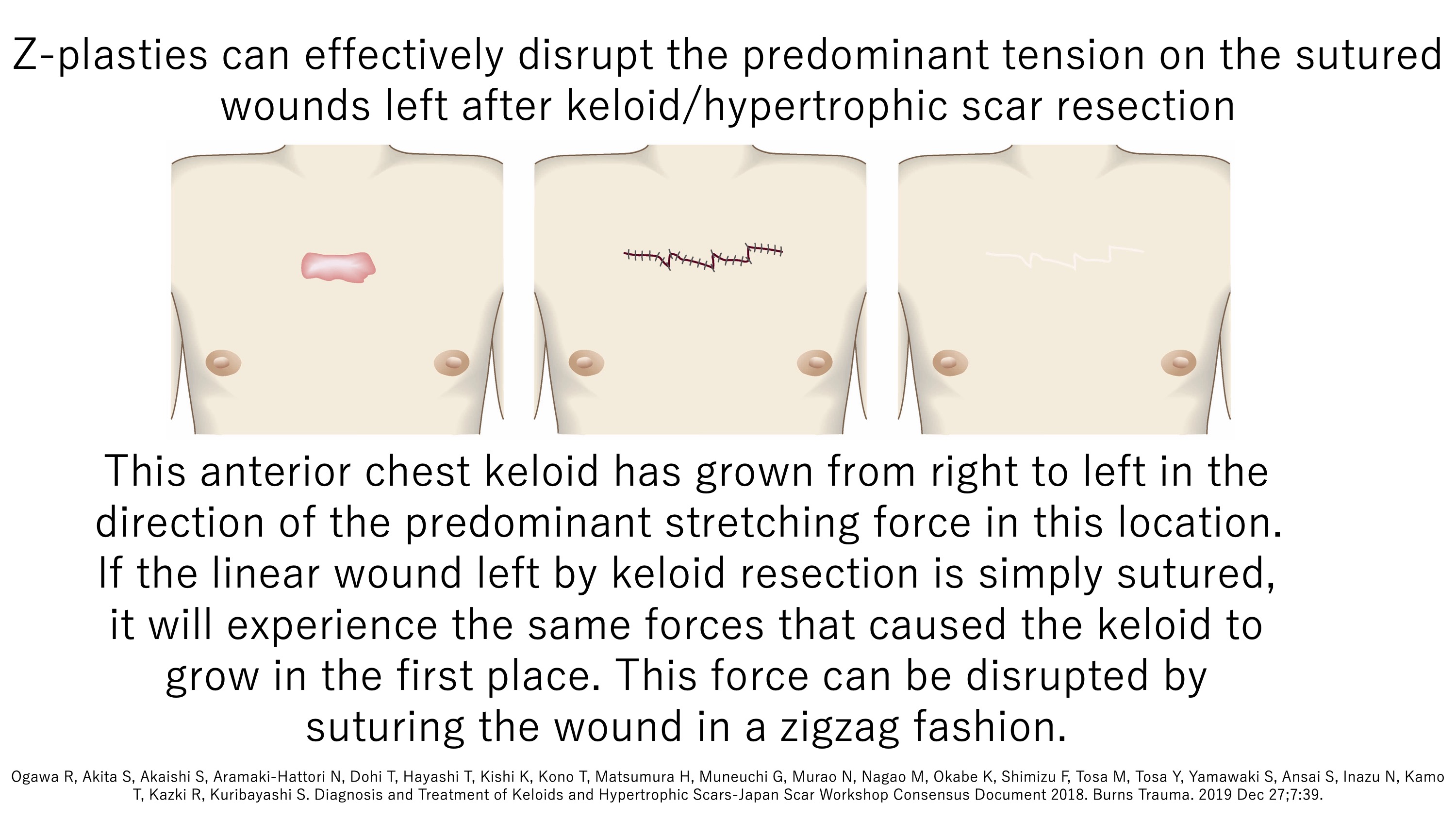keloid laboratory