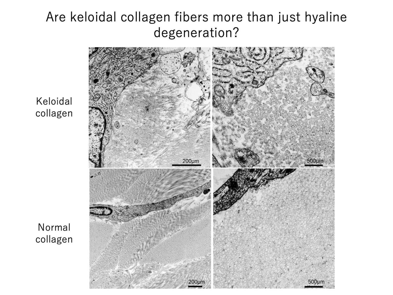 keloid laboratory