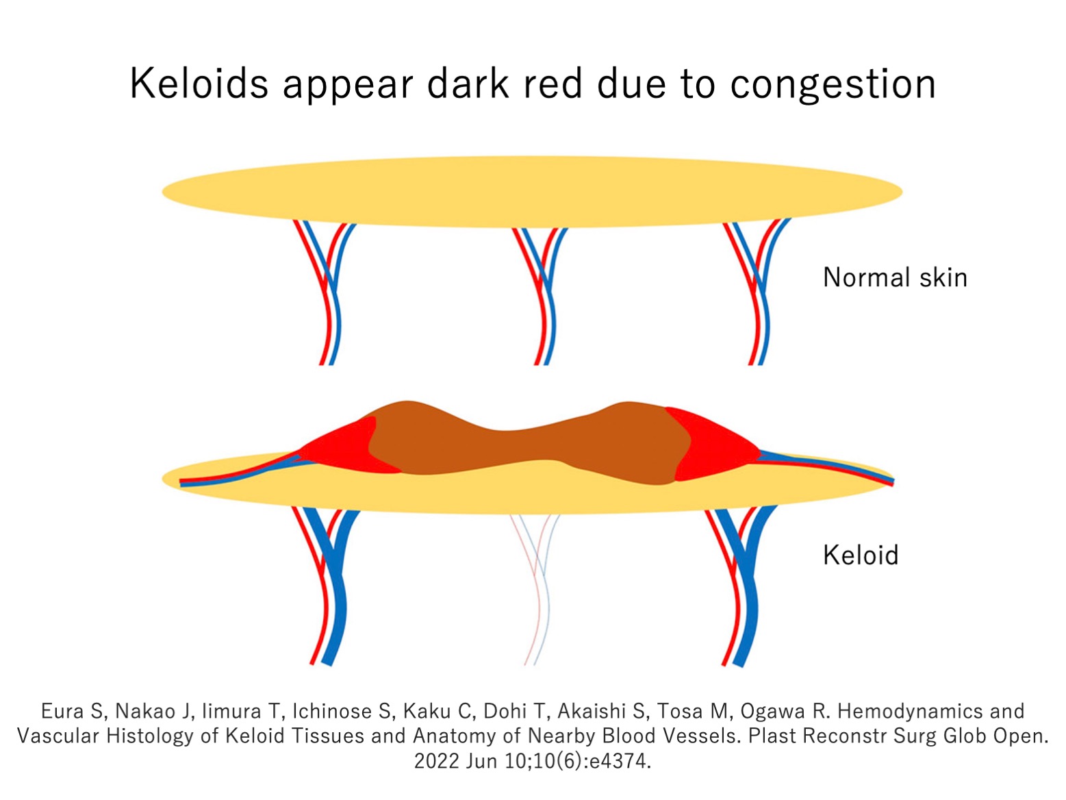 keloid laboratory