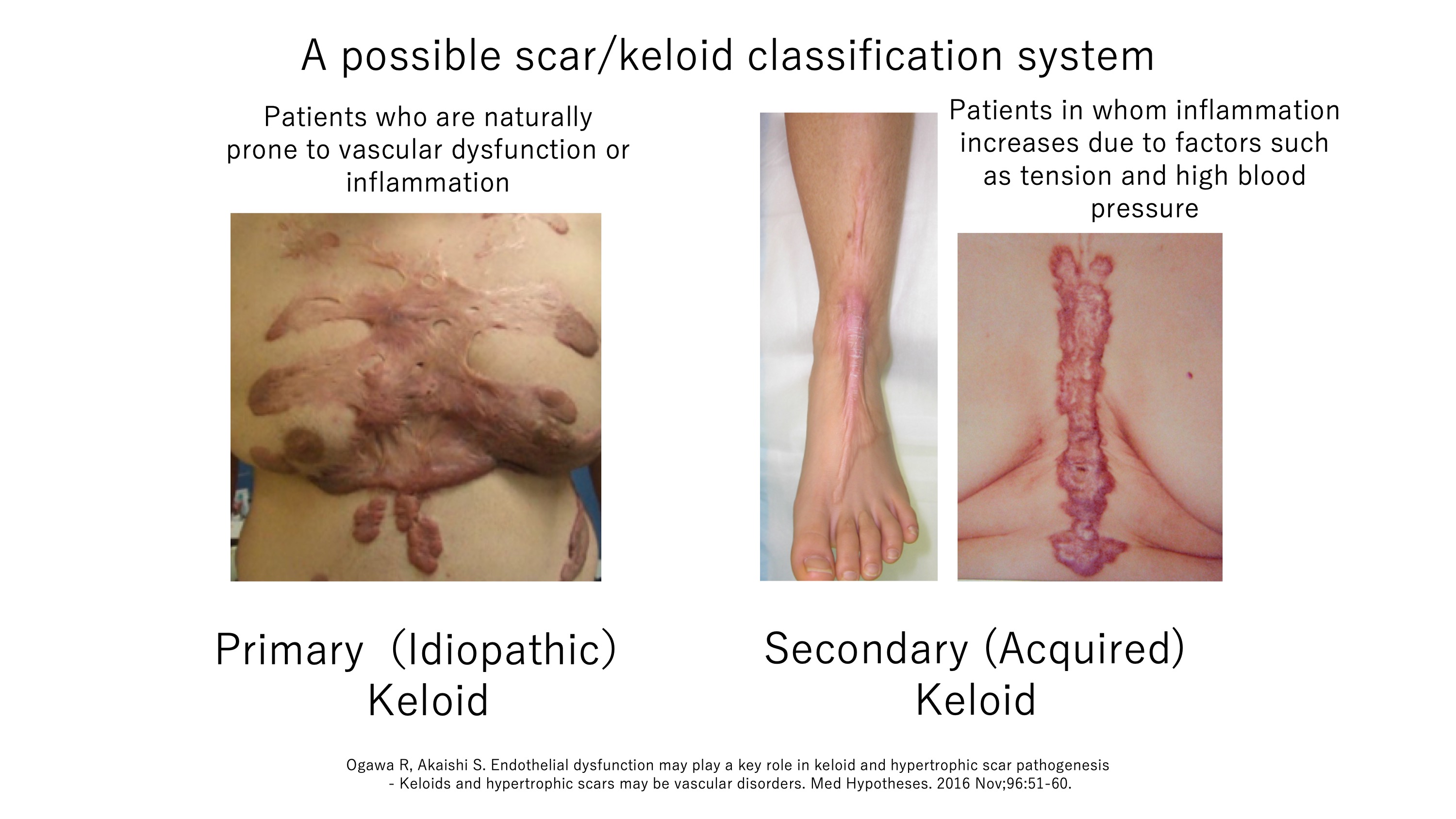 keloid laboratory